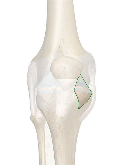 The Medial Patellar Retinaculum: 3D Anatomy Model