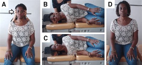 Gufoni's maneuver to treat HC-BPPV cupulolithiasis. Patient sits... | Download Scientific Diagram