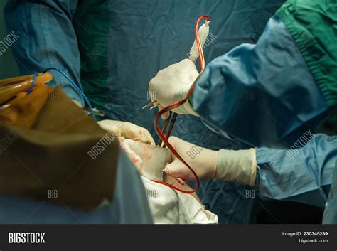 Operation Trepanation Image & Photo (Free Trial) | Bigstock