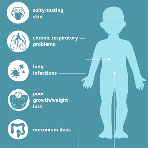 Cystic Fibrosis: Signs, Symptoms, and Complications