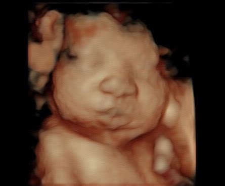 34 Week Ultrasound - Reveal 3D/4D Ultrasound Studio