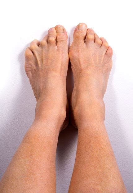 Ankle Arthritis Treatment | Surgical & Non Surgical Pain Relief Treatments