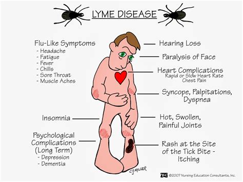 Lyme disease - world of desire