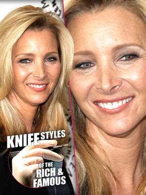 Lisa Kudrow: I Had A Nose Job So I Didn’t Look 'Hideous'