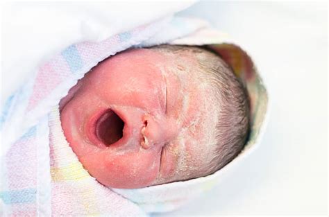 40+ Vernix Stock Photos, Pictures & Royalty-Free Images - iStock