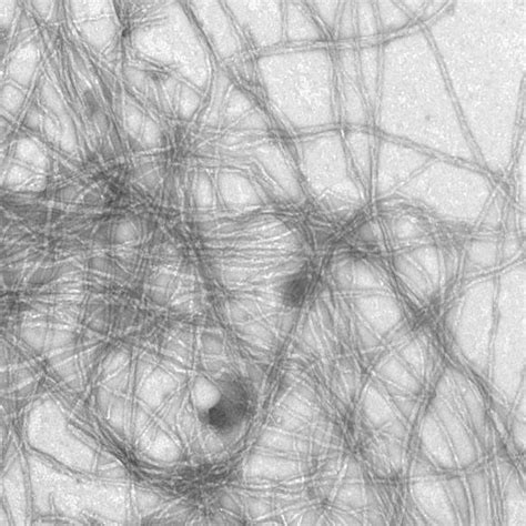 1 Amyloid fibrils and fibrillization kinetics. (A) Negatively stained... | Download Scientific ...