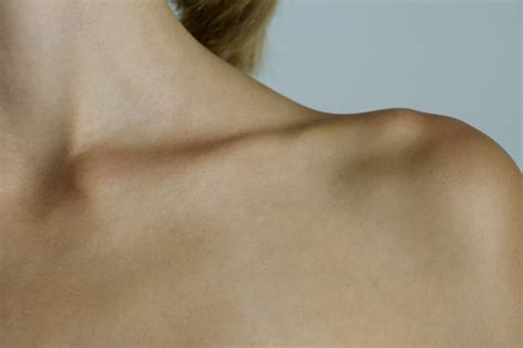 Broken Collarbone: Symptoms, Causes, Diagnosis, and Treatment