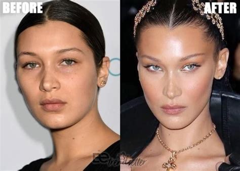 Bella Hadid: Fox Eyes in 2022 | Plastic surgery, Celebrity plastic ...