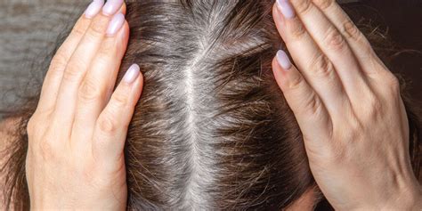 Burning scalp syndrome: what is trichodynia? - Galaxus