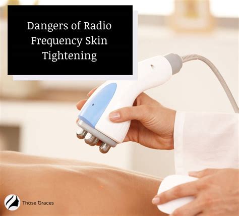 7 Possible Dangers of Radio Frequency Skin Tightening (Doctor's Answer) - ThoseGraces.com