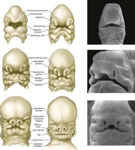 Development of the Face - Nose - Palate - Cleft Lip - TeachMeAnatomy