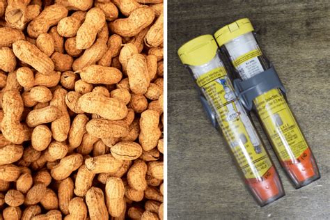 Your Child's Classmate Has A Peanut Allergy...Now What? - Full Green Life