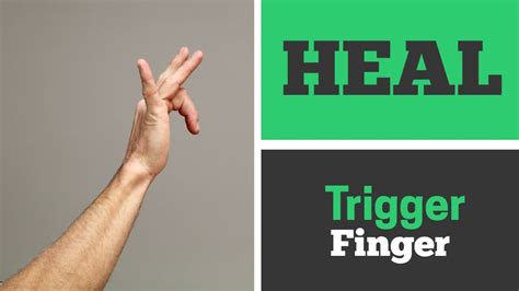 How to Heal Trigger Finger with 4 Exercises That Work! (Real Patient ...