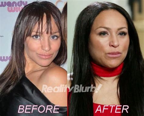 Darcey and stacey plastic surgery 2021