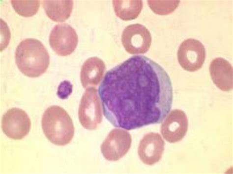 Promonocyte