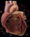 Posterior descending artery - Wikipedia