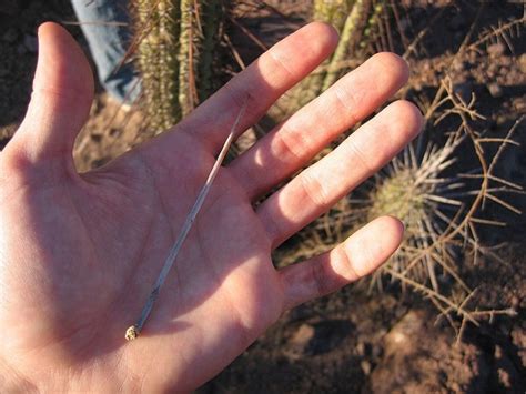 How To Remove Cactus Spines From Your Perforated Body | KCET