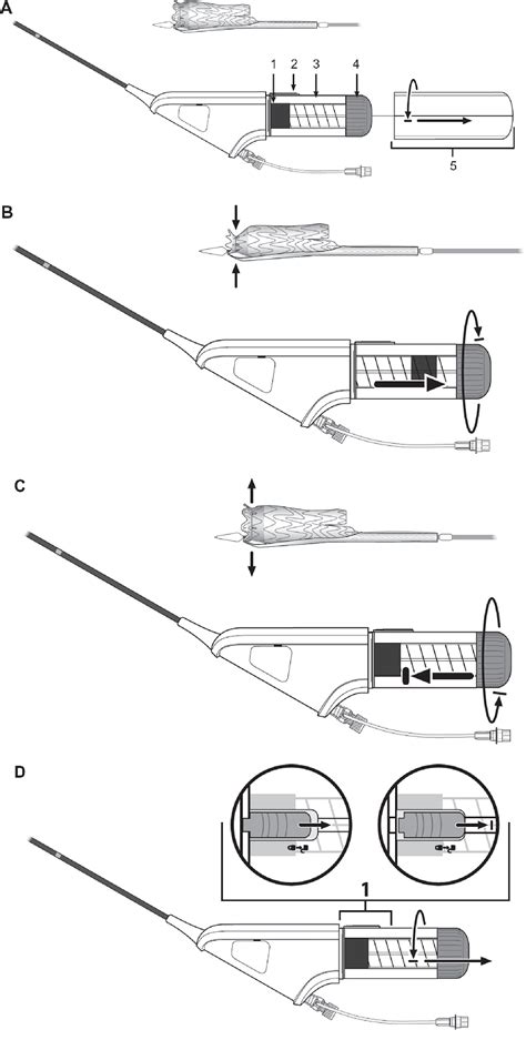 Figure 2 from Gore excluder device with the C3 delivery system for management of abdominal ...