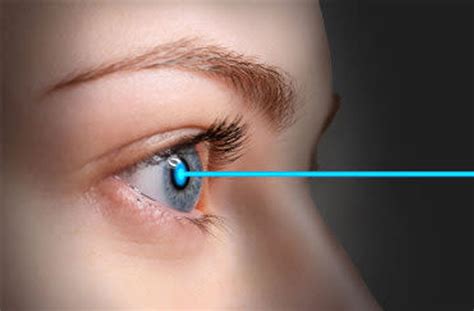 Laser Eye Surgery for Astigmatism in Melbourne | NewVision Clinics