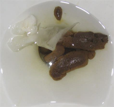 File:Human feces in toilet.jpg - Wikipedia