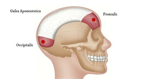 Epicranius - How To Find Trigger Points (for Headache) - YouTube