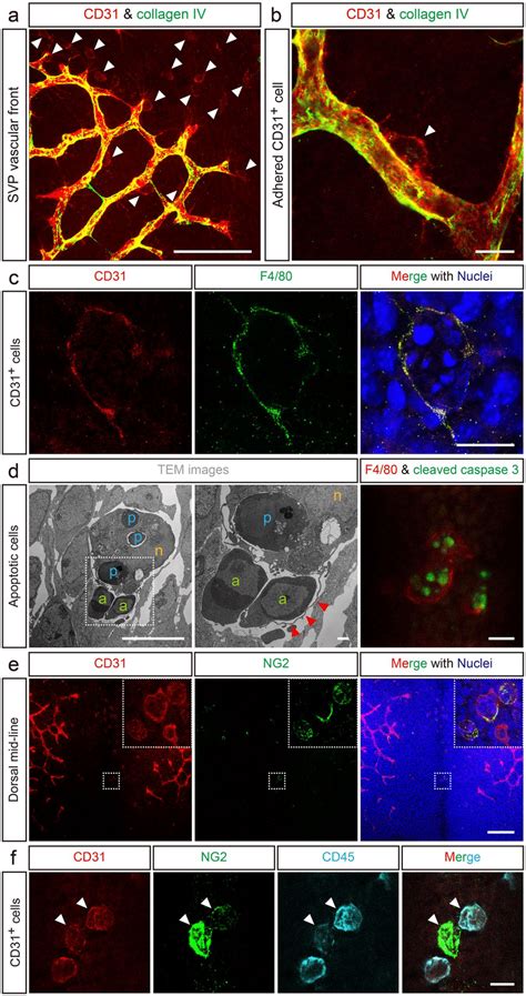 CD31 + F4/80 + cells have a mature macrophage phenotype and express a ...