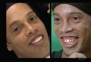 Ronaldinho Dazzles After Undergoing Surgery To Correct Teeth (PHOTOS ...