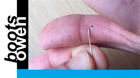 Quick and easy way to remove a stubborn thorn or splinter in your finger - YouTube