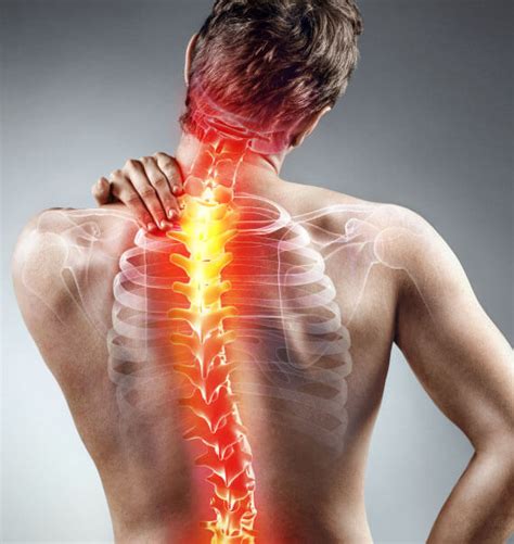 Scoliosis Pain Management Guide | NSC