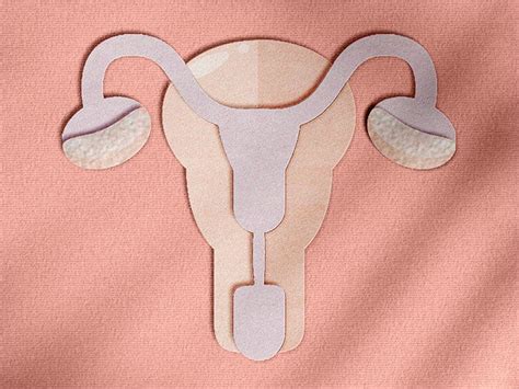 Ovarian teratoma: Symptoms, causes, and more