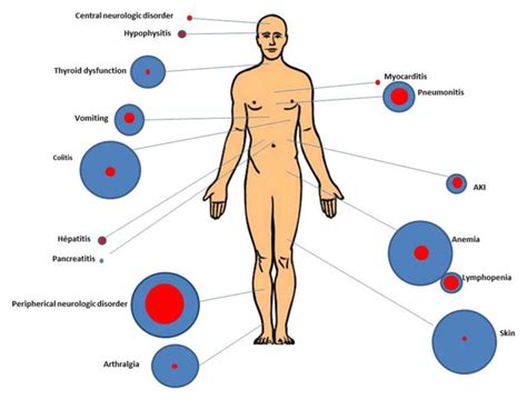 Investigating the Side Effects of Cancer Immunotherapy - NCI