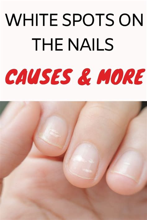 Looking beautiful and well-groomed nails is an indicator of being ...