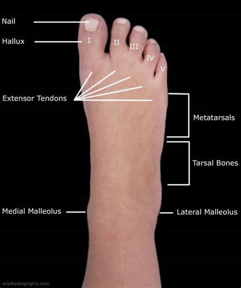 Metatarsals Numbered