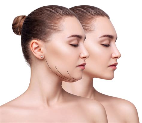 Neck Lipo Recovery: Understanding Swelling | Newburgh, NY