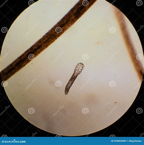 Demodex Folliculorum - Parasitic Mite on the Eyelashes of a Human Eye ...