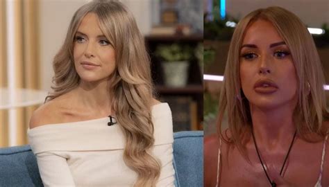 'Love Island' star Faye Winter reveals she dissolved her lip fillers as they made her look ...