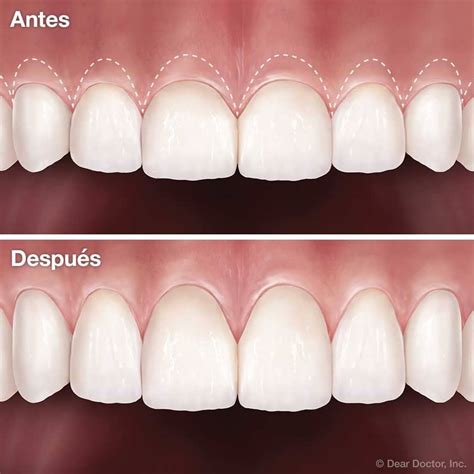 Patient Education | Austin, TX Dentist - Advanced Smiles Dental, P.A.