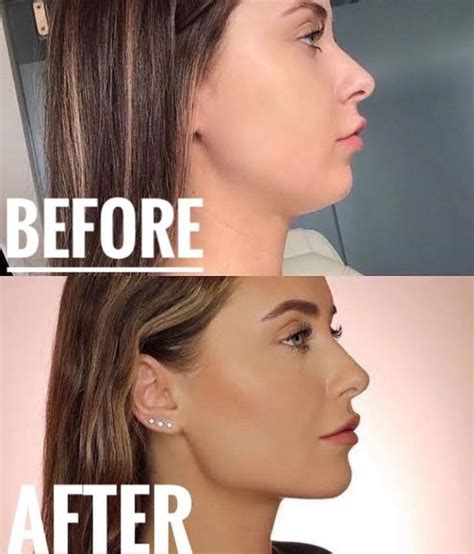 The 5 Best Jawline Exercisers Plus Jaw Exercise Guide | Good jawline, Jawline, Jaw exercises