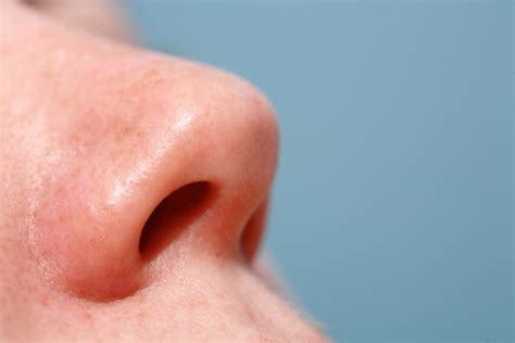 Pimple in Nose: Causes and Treatment