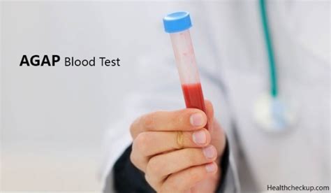 AGAP(Anion Gap) Blood Test - Signs, Causes, Preparation, Procedure, Results, Treatment