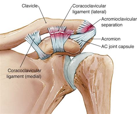 Arthritis and AC Joint Dislocation Surgeries in Bangalore - Dr.Nataraj H M