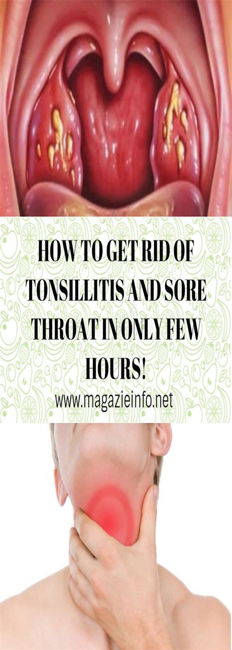 download (7) | Health tips, Sore throat remedies, Fitness facts