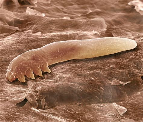 Eyelash Mite, Sem by Power And Syred in 2022 | Things under a microscope, Microscopic ...
