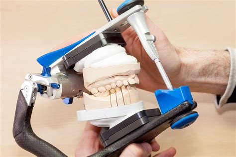 Impact of Recessed Jaw and Overbite (Retrognathia)