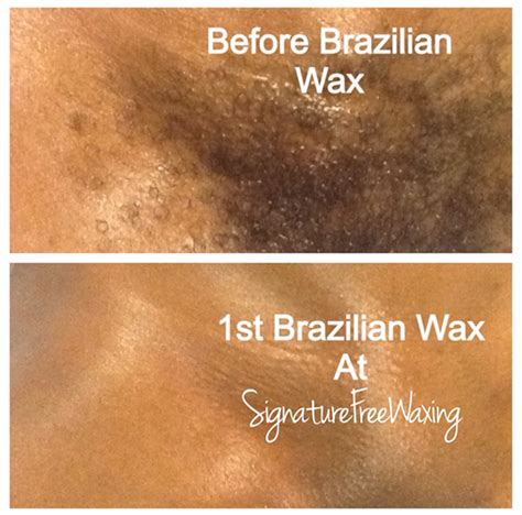 best brazilian wax chicago - Skye Handy