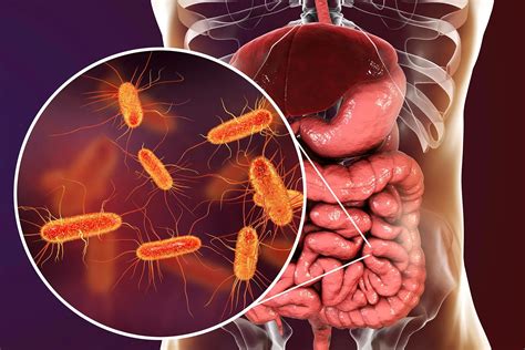 E. coli Bacteria Infection: Symptoms, Treatment and Prevention
