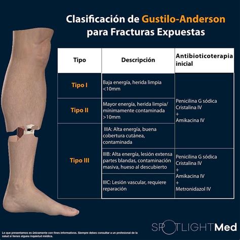 Clasificación de Gustilo-Anderson:Para fracturas Expuestas. Fuente ...