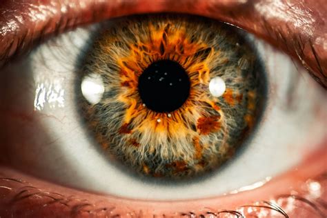 What is a Retinal Vein Occlusion and How is it Treated? | Abraham Eye