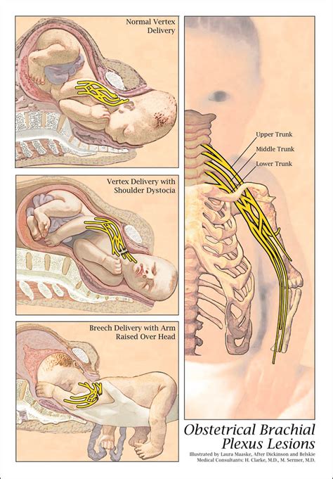 Plexus Poster new - Medical Illustrations & Animations by Laura Maaske Medical Illustrator ...