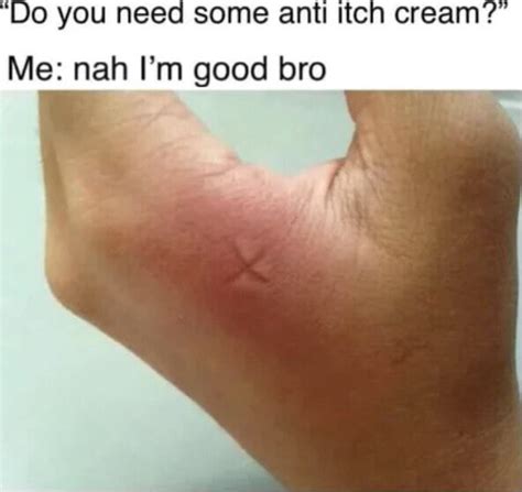'Do you need some anti Itch cream?" Me: nah I'm good bro - iFunny